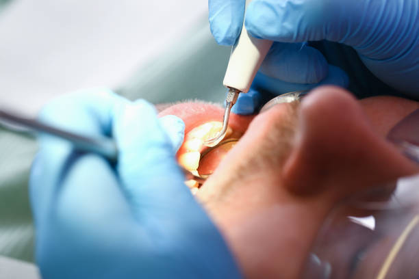 Best Emergency Treatment for Toothache in Dawson, TX