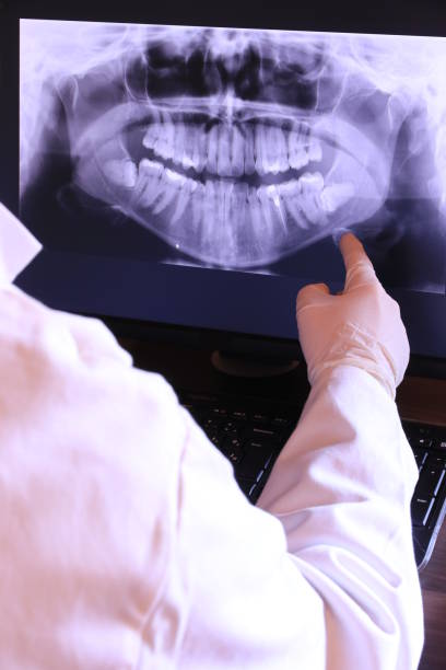 Best Emergency Root Canal Treatment in Dawson, TX