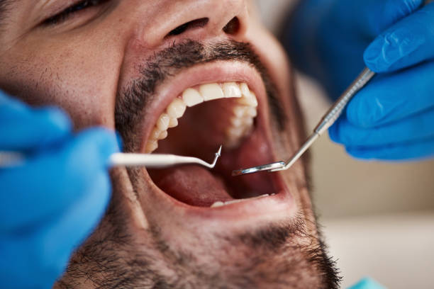 Best Emergency Dental Surgery in Dawson, TX